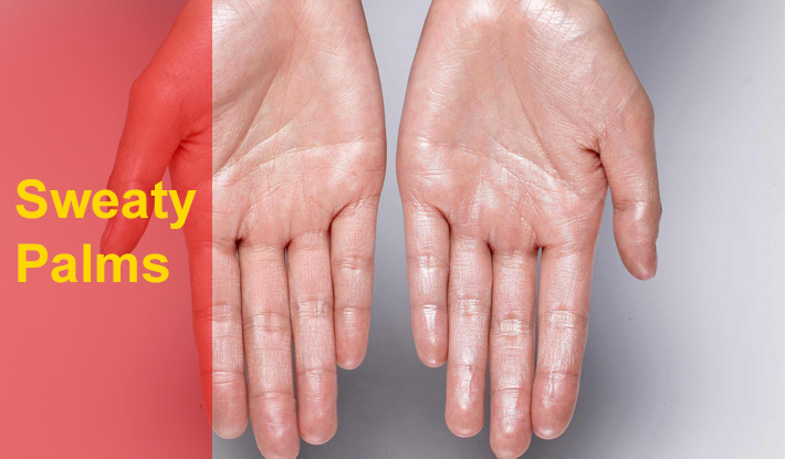sweaty palms treatment doctor in ahmedabad